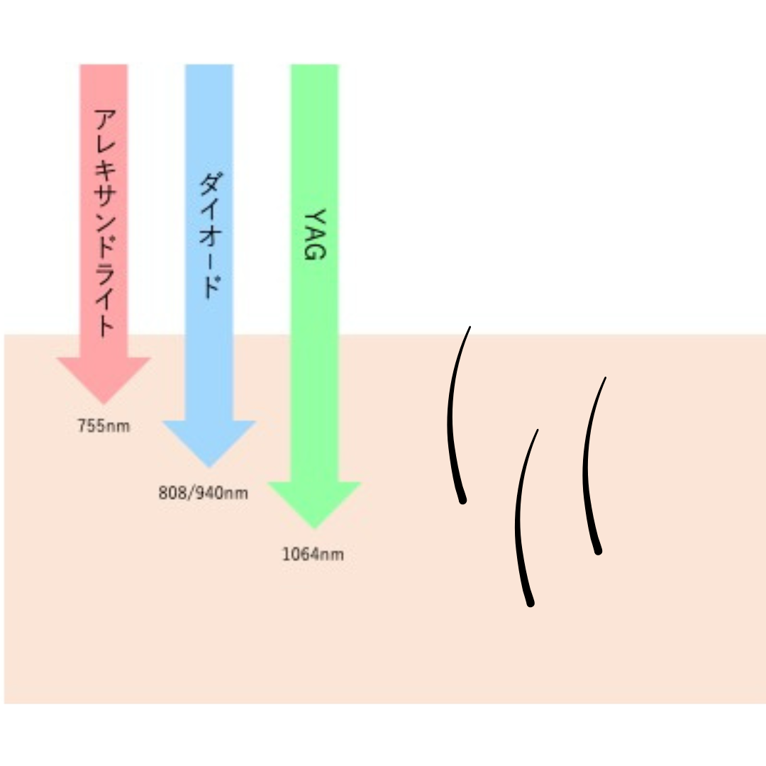 当院の医療レーザー脱毛の波長の説明図